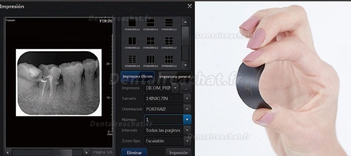 Fussen Scanner plaque d imagerie numérique scanner PSP dentaire